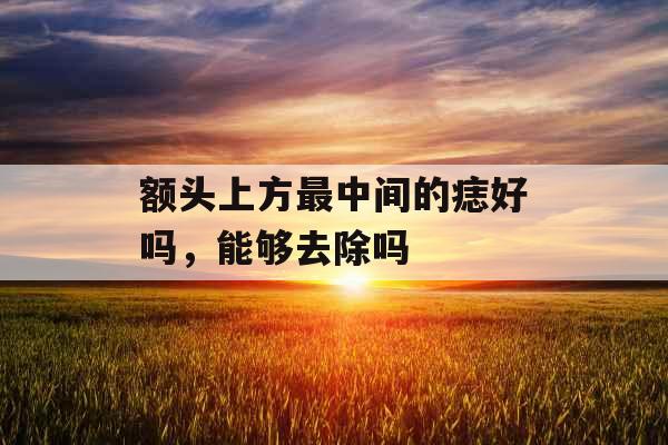 额头上方最中间的痣好吗,能够去除吗 额头上方最中间的痣好吗,能够去除吗